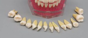 دندان دوفک با قابلیت جداشدن دندان