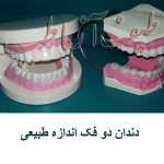 دندان دوفک طبیعی